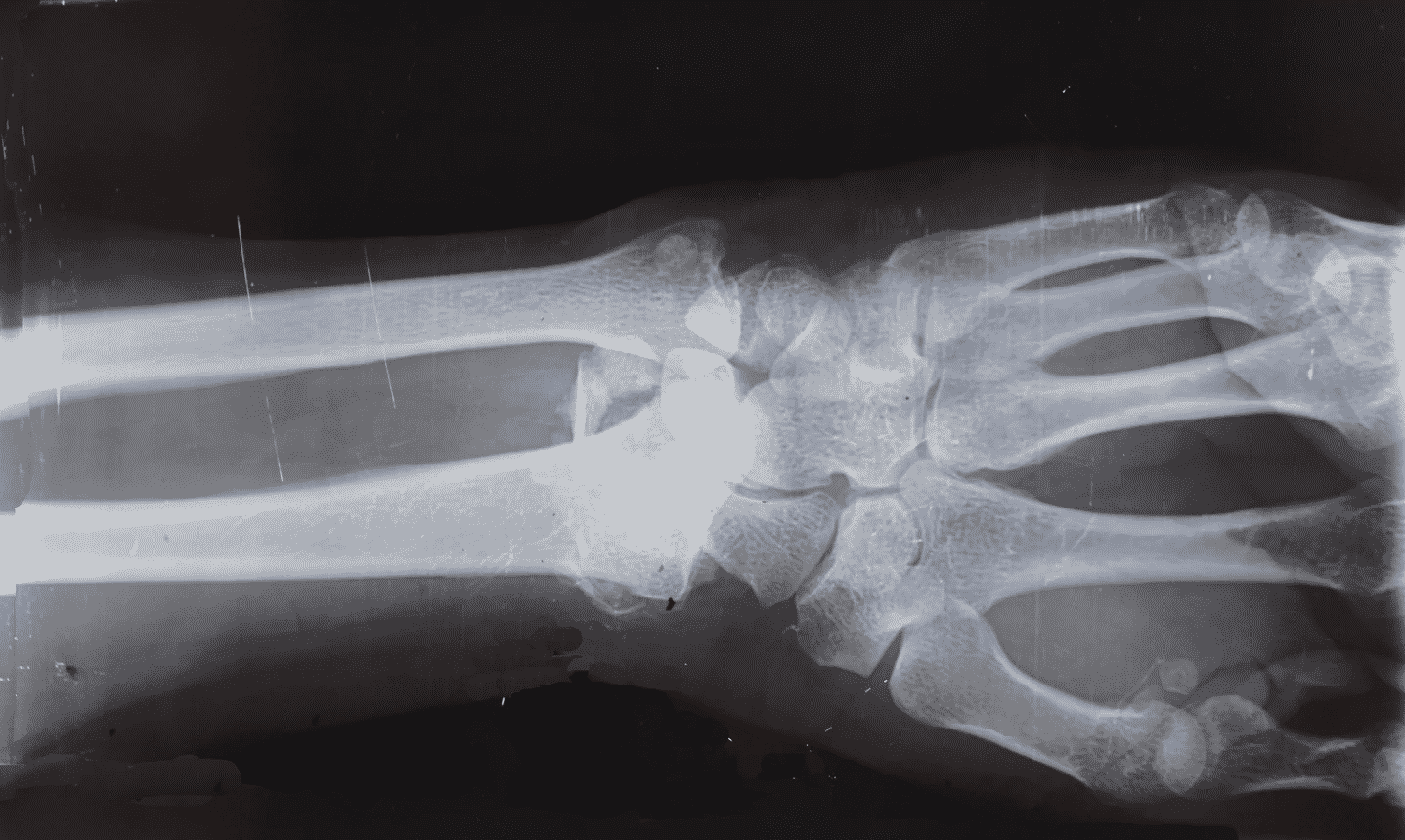 Everything you need to know about radiation badges Med Pro